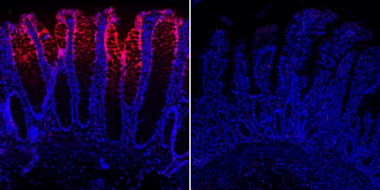 Carbonic Anhydrase II/CA2 was detected in immersion fixed paraffin-embedded sections of human descending colon (left panel) and ileum (right panel) using Rat Anti-Human/Mouse Carbonic Anhydrase II/CA2 Monoclonal Antibody (Catalog # MAB2184) at 0.5 µg/mL overnight at 4 °C. Tissue was stained using the NorthernLights™ 557-conjugated Anti-Rat IgG Secondary Antibody (red; Catalog # NL013) and counterstained with DAPI (blue).