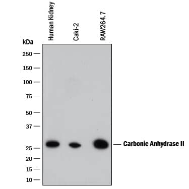 Western blot shows lysates of human kidney tissue, Caki-2 human clear cell carcinoma epithelial cell line, and RAW 264.7 mouse monocyte/macrophage cell line. PVDF membrane was probed with 2 µg/mL of Rat Anti-Human/Mouse Carbonic Anhydrase II/ CA2 Monoclonal Antibody (Catalog # MAB2184) followed by HRP-conjugated Anti-Rat IgG Secondary Antibody (Catalog # HAF005). A specific band was detected for Carbonic Anhydrase II/CA2 at approximately 27 kDa (as indicated). This experiment was conducted under reducing conditions and using Immunoblot Buffer Group 1.