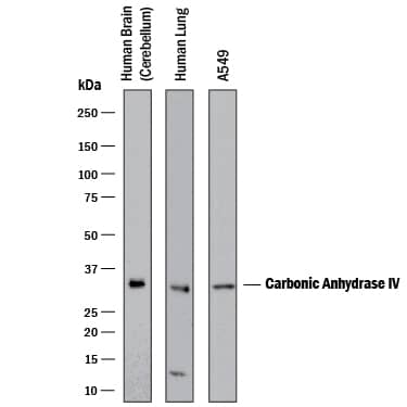 Western blot shows lysates of human brain (cerebellum) tissue, human lung tisssue, and A549 human lung carcinoma cell line. PVDF membrane was probed with 1 µg/mL of Goat Anti-Human Carbonic Anhydrase IV/CA4 Antigen Affinity-purified Polyclonal Antibody (Catalog # AF2186) followed by HRP-conjugated Anti-Goat IgG Secondary Antibody (HAF017). A specific band was detected for Carbonic Anhydrase IV/CA4 at approximately 33 kDa (as indicated). This experiment was conducted under reducing conditions and using Immunoblot Buffer Group 1.