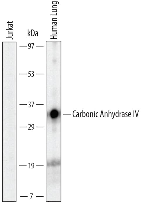 Western blot shows lysates of Jurkat human acute T cell leukemia cell line and human lung tissue. PVDF Membrane was probed with 2 µg/mL of Mouse Anti-Human Carbonic Anhydrase IV/CA4 Monoclonal Antibody (Catalog # MAB21861) followed by HRP-conjugated Anti-Mouse IgG Secondary Antibody (Catalog # HAF007). A specific band was detected for Carbonic Anhydrase IV/CA4 at approximately 35 kDa (as indicated). This experiment was conducted under non-reducing conditions and using Immunoblot Buffer Group 1.