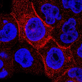 Carbonic Anhydrase IX/CA9 was detected in immersion fixed A431 human epithelial carcinoma cell line using Goat Anti-Human Carbonic Anhydrase IX/CA9 Antigen Affinity-purified Polyclonal Antibody (Catalog # AF2188) at 3 µg/mL for 3 hours at room temperature. Cells were stained using the NorthernLights™ 557-conjugated Anti-Goat IgG Secondary Antibody (red; NL001) and counterstained with DAPI (blue). Specific staining was localized to cytoplasm. View our protocol for Fluorescent ICC Staining of Cells on Coverslips.