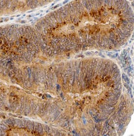 Carbonic Anhydrase IX/CA9 was detected in immersion fixed paraffin-embedded sections of human colon using Mouse Anti-Human Carbonic Anhydrase IX/CA9 Monoclonal Antibody (Catalog # MAB21881) at 15 µg/mL overnight at 4 °C. Before incubation with the primary antibody, tissue was subjected to heat-induced epitope retrieval using Antigen Retrieval Reagent-Basic (Catalog # CTS013). Tissue was stained using the Anti-Mouse HRP-DAB Cell & Tissue Staining Kit (brown; Catalog # CTS002) and counterstained with hematoxylin (blue). Specific staining was localized to cytoplasm. View our protocol for Chromogenic IHC Staining of Paraffin-embedded Tissue Sections.