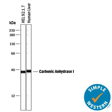 Simple Western lane view shows lysates of HEL 92.1.7 human erythroleukemic cell line and human liver tissue, loaded at 0.2 mg/mL. A specific band was detected for Carbonic Anhydrase I/CA1 at approximately 38 kDa (as indicated) using 5 µg/mL of Goat Anti-Human Carbonic Anhydrase I/CA1 Antigen Affinity-purified Polyclonal Antibody (Catalog # AF2180) followed by 1:50 dilution of HRP-conjugated Anti-Goat IgG Secondary Antibody (Catalog # HAF109). This experiment was conducted under reducing conditions and using the 12-230 kDa separation system.