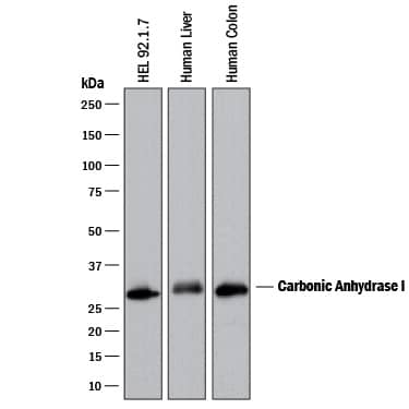 Western blot shows lysates of HEL 92.1.7 human erythroleukemic cell line, human liver tissue, and human colon tissue. PVDF membrane was probed with 0.1 µg/mL of Goat Anti-Human Carbonic Anhydrase I/CA1 Antigen Affinity-purified Polyclonal Antibody (Catalog # AF2180) followed by HRP-conjugated Anti-Goat IgG Secondary Antibody (Catalog # HAF017). A specific band was detected for Carbonic Anhydrase I/CA1 at approximately 30 kDa (as indicated). This experiment was conducted under reducing conditions and using Immunoblot Buffer Group 1.
