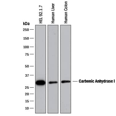 Western blot shows lysates of HEL 92.1.7 human erythroleukemic cell line, human liver tissue, and human colon tissue. PVDF membrane was probed with 0.5 µg/mL of Rat Anti-Human Carbonic Anhydrase I/CA1 Monoclonal Antibody (Catalog # MAB2180) followed by HRP-conjugated Anti-Rat IgG Secondary Antibody (Catalog # HAF005). A specific band was detected for Carbonic Anhydrase I/CA1 at approximately 30 kDa (as indicated). This experiment was conducted under reducing conditions and using Immunoblot Buffer Group 1.