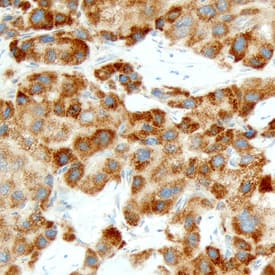 Immunohistochemistry Carbonic Anhydrase VA/CA5A Antibody
