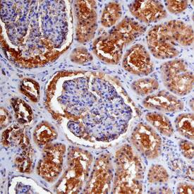Carbonic Anhydrase VB/CA5B was detected in immersion fixed paraffin-embedded sections of human kidney using Goat Anti-Human Carbonic Anhydrase VB/ CA5B Antigen Affinity-purified Polyclonal Antibody (Catalog # AF3176) at 3 µg/mL overnight at 4 °C. Before incubation with the primary antibody, tissue was subjected to heat-induced epitope retrieval using Antigen Retrieval Reagent-Basic (Catalog # CTS013). Tissue was stained using the Anti-Goat HRP-DAB Cell & Tissue Staining Kit (brown; Catalog # CTS008) and counterstained with hematoxylin (blue). Specific staining was localized to epithelial cells in convoluted tubules. View our protocol for Chromogenic IHC Staining of Paraffin-embedded Tissue Sections.