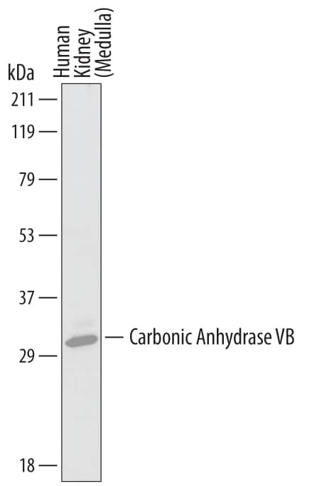 Western blot shows lysates of human kidney (medulla) tissue. PVDF membrane was probed with 1 µg/mL of Goat Anti-Human Carbonic Anhydrase VB/CA5B Antigen Affinity-purified Polyclonal Antibody (Catalog # AF3176) followed by HRP-conjugated Anti-Goat IgG Secondary Antibody (Catalog # HAF019). A specific band was detected for Carbonic Anhydrase VB/CA5B at approximately 32 kDa (as indicated). This experiment was conducted under reducing conditions and using Immunoblot Buffer Group 1.