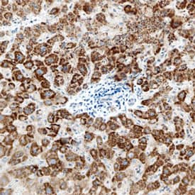 Carbonic Anhydrase VA/VB (CA5A/5B) was detected in immersion fixed paraffin-embedded sections of human liver using Mouse Anti-Human Carbonic Anhydrase VA/ VB (CA5A/5B) Monoclonal Antibody (Catalog # MAB5388) at 15 µg/mL overnight at 4 °C. Before incubation with the primary antibody, tissue was subjected to heat-induced epitope retrieval using Antigen Retrieval Reagent-Basic (Catalog # CTS013). Tissue was stained using the Anti-Mouse HRP-DAB Cell & Tissue Staining Kit (brown; Catalog # CTS002) and counterstained with hematoxylin (blue). Specific staining was localized to the cytoplasm of hepatocytes. View our protocol for Chromogenic IHC Staining of Paraffin-embedded Tissue Sections.