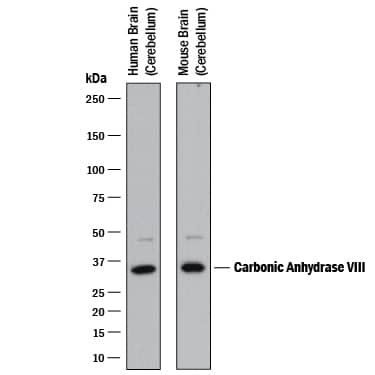 Western Blot Carbonic Anhydrase VIII/CA8 Antibody [Unconjugated]