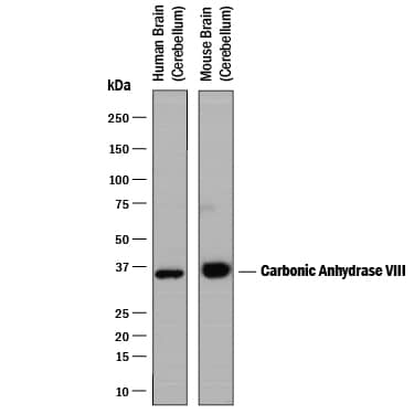 Western blot shows lysates of human brain (cerebellum) tissue and mouse brain (cerebellum) tissue. PVDF membrane was probed with 1 µg/mL of Mouse Anti-Human/Mouse Carbonic Anhydrase VIII/CA8 Monoclonal Antibody (Catalog # MAB2187) followed by HRP-conjugated Anti-Mouse IgG Secondary Antibody (Catalog # HAF018). A specific band was detected for Carbonic Anhydrase VIII/CA8 at approximately 36 kDa (as indicated). This experiment was conducted under reducing conditions and using Immunoblot Buffer Group 1.