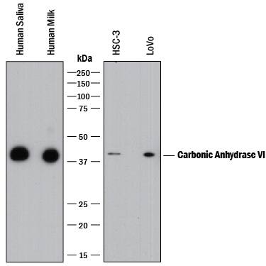 Western blot shows human saliva, human milk, and lysates of HSC-3 human oral squamous cell carcinoma cell line and LoVo human colorectal adenocarcinoma cell line. PVDF membrane was probed with 0.5 µg/mL of Goat Anti-Human Carbonic Anhydrase VI Antigen Affinity-purified Polyclonal Antibody (Catalog # AF2939) followed by HRP-conjugated Anti-Goat IgG Secondary Antibody (Catalog # HAF017). A specific band was detected for Carbonic Anhydrase VI at approximately 42 kDa (as indicated). This experiment was conducted under reducing conditions and using Immunoblot Buffer Group 1.