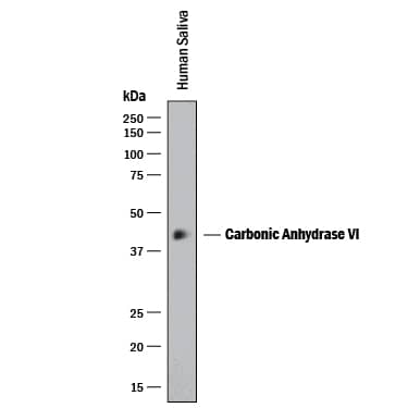 Western blot shows human saliva. PVDF membrane was probed with 1 µg/mL of Mouse Anti-Human Carbonic Anhydrase VI Monoclonal Antibody (Catalog # MAB2939) followed by HRP-conjugated Anti-Mouse IgG Secondary Antibody (Catalog # HAF018). A specific band was detected for Carbonic Anhydrase VI at approximately 42 kDa (as indicated). This experiment was conducted under reducing conditions and using Immunoblot Buffer Group 1.