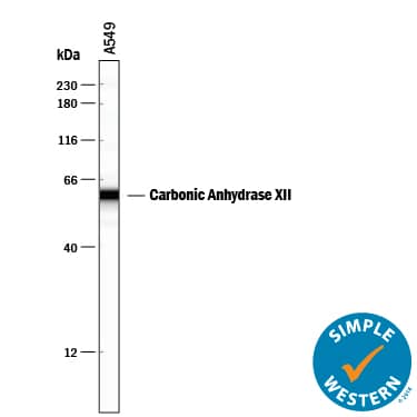 Simple Western Carbonic Anhydrase XII/CA12 Antibody [Unconjugated]