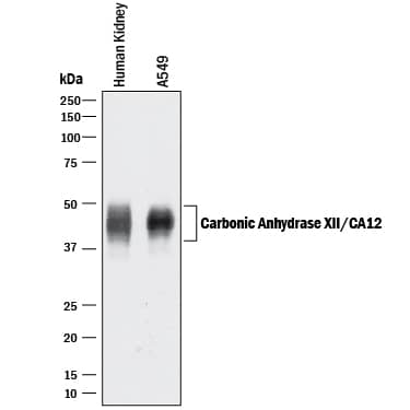 Western Blot Carbonic Anhydrase XII/CA12 Antibody [Unconjugated]