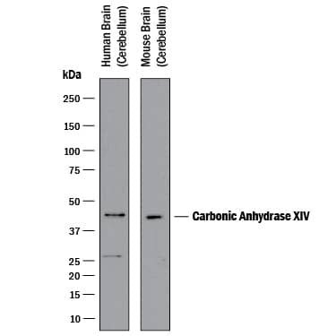 Western blot shows lysates of human and mouse brain (cerebellum) tissue. PVDF membrane was probed with 1 µg/mL of Goat Anti-Human/Mouse Carbonic Anhydrase XIV/CA14 Antigen Affinity-purified Polyclonal Antibody (Catalog # AF2195) followed by HRP-conjugated Anti-Goat IgG Secondary Antibody (HAF017). A specific band was detected for Carbonic Anhydrase XIV/CA14 at approximately 42 kDa (as indicated). This experiment was conducted under reducing conditions and using Immunoblot Buffer Group 1.