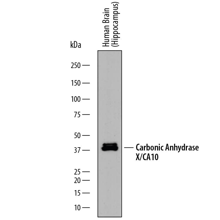 Western blot shows lysates of human brain (hippocampus) tissue. PVDF membrane was probed with 1.5 µg/mL of Mouse Anti-Human Carbonic Anhydrase X/CA10 Monoclonal Antibody (Catalog # MAB2189) followed by HRP-conjugated Anti-Mouse IgG Secondary Antibody (Catalog # HAF018). Specific bands were detected for Carbonic Anhydrase X/CA10 at approximately 38-42 kDa (as indicated). This experiment was conducted under reducing conditions and using Immunoblot Buffer Group 1.
