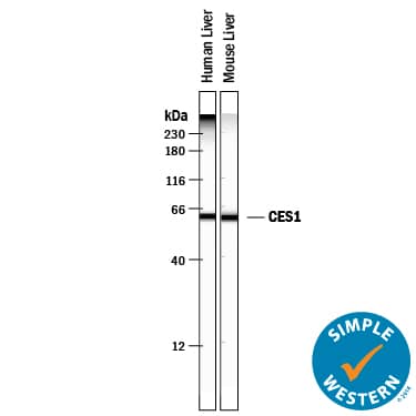 Simple Western lane view shows lysates of human liver tissue and mouse liver tissue, loaded at 0.2 mg/mL. A specific band was detected for Carboxylesterase 1/CES1 at approximately 62 kDa (as indicated) using 2 µg/mL of Goat Anti-Human/Mouse/Rat Carboxylesterase 1/CES1 Antigen Affinity-purified Polyclonal Antibody (Catalog # AF4920) followed by 1:50 dilution of HRP-conjugated Anti-Goat IgG Secondary Antibody (Catalog # HAF109). This experiment was conducted under reducing conditions and using the 12-230 kDa separation system.