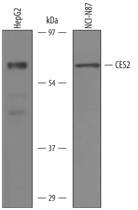 Western Blot Carboxylesterase 2/CES2 Antibody [Unconjugated]