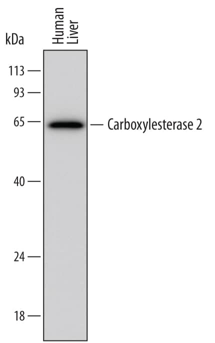 Western blot shows lysates of human liver tissue. PVDF membrane was probed with 2 µg/mL of Mouse Anti-Human Carboxylesterase 2/CES2 Monoclonal Antibody (Catalog # MAB5657) followed by HRP-conjugated Anti-Mouse IgG Secondary Antibody (Catalog # HAF007). A specific band was detected for Carboxylesterase 2/CES2 at approximately 62 kDa (as indicated). This experiment was conducted under reducing conditions and using Immunoblot Buffer Group 1.