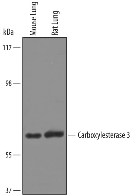 Western Blot Carboxylesterase 3/CES3/Esterase 31 Antibody
