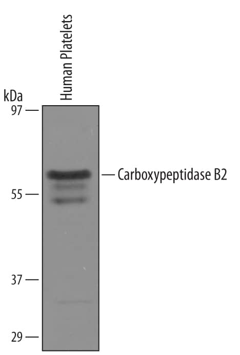 Western Blot Carboxypeptidase B2/CPB2 Antibody [Unconjugated]