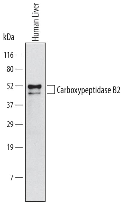 Western blot shows lysates of human liver tissue. PVDF Membrane was probed with 2 µg/mL of Human Carboxypeptidase B2/CPB2 Monoclonal Antibody (Catalog # MAB6036) followed by HRP-conjugated Anti-Mouse IgG Secondary Antibody (Catalog # HAF007). Specific bands were detected for Carboxypeptidase B2/CPB2 at approximately 45 and 50 kDa (as indicated). This experiment was conducted under non-reducing conditions and using Immunoblot Buffer Group 1.