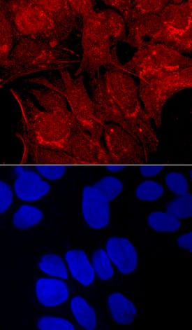 Immunocytochemistry Carboxypeptidase E/CPE Antibody [Unconjugated]