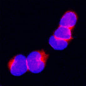 Carboxypeptidase M was detected in immersion fixed THP-1 human acute monocytic leukemia cell line using Sheep Anti-Human Carboxypeptidase M Antigen Affinity-purified Polyclonal Antibody (Catalog # AF7457) at 15 µg/mL for 3 hours at room temperature. Cells were stained using the NorthernLights™ 557-conjugated Anti-Sheep IgG Secondary Antibody (red; Catalog # NL010) and counterstained with DAPI (blue). Specific staining was localized to plasma membrane and cytoplasm. View our protocol for Fluorescent ICC Staining of Non-adherent Cells.