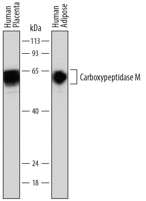 Western blot shows lysates of human placenta tissue and human adipose tissue. PVDF membrane was probed with 1 µg/mL of Sheep Anti-Human Carboxypeptidase M Antigen Affinity-purified Polyclonal Antibody (Catalog # AF7457) followed by HRP-conjugated Anti-Sheep IgG Secondary Antibody (Catalog # HAF016). A specific band was detected for Carboxypeptidase M at approximately 58-65 kDa (as indicated). This experiment was conducted under reducing conditions and using Immunoblot Buffer Group 1.