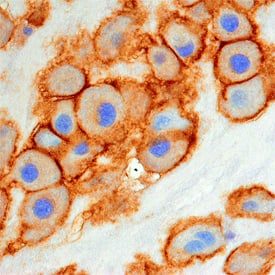 Carboxypeptidase M was detected in immersion fixed paraffin-embedded sections of human placenta using Mouse Anti-Human Carboxypeptidase M Monoclonal Antibody (Catalog # MAB7457) at 15 µg/mL overnight at 4 °C. Tissue was stained using the Anti-Mouse HRP-DAB Cell & Tissue Staining Kit (brown; Catalog # CTS002) and counter-stained with hematoxylin (blue). Specific staining was localized to plasma membranes of decidual cells. View our protocol for Chromogenic IHC Staining of Paraffin-embedded Tissue Sections.