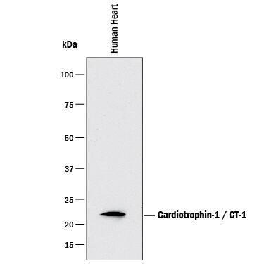Western Blot Cardiotrophin-1/CT-1 Antibody (89221) [Unconjugated]