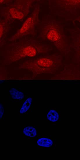 Carm1 was detected in immersion fixed HeLa human cervical epithelial carcinoma cell line using Goat Anti-Human Carm1 Antigen Affinity-purified Polyclonal Antibody (Catalog # AF7277) at 10 µg/mL for 3 hours at room temperature. Cells were stained using the NorthernLights™ 557-conjugated Anti-Goat IgG Secondary Antibody (red, upper panel; Catalog # NL001) and counterstained with DAPI (blue, lower panel). Specific staining was localized to nuclei and cytoplasm. View our protocol for Fluorescent ICC Staining of Cells on Coverslips.