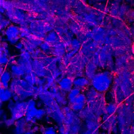 Carnosine Dipeptidase 1/CNDP1 was detected in immersion fixed BG01V human embryonic stem cells differentiated into neurons using Mouse Anti-Human Carnosine Dipeptidase 1/CNDP1 Monoclonal Antibody (Catalog # MAB2489) at 10 µg/mL for 3 hours at room temperature. Cells were stained using the NorthernLights™ 557-conjugated Anti-Mouse IgG Secondary Antibody (red; Catalog # NL007) and counterstained with DAPI (blue). Specific staining was localized to cytoplasm. View our protocol for Fluorescent ICC Staining of Stem Cells on Coverslips.