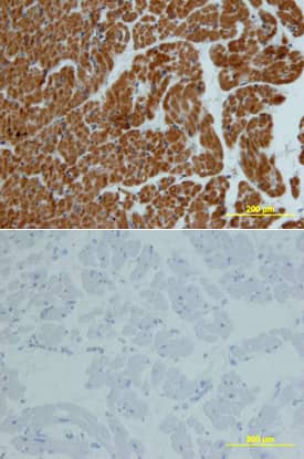 Carnosine Dipeptidase 1/CNDP1 was detected in immersion fixed paraffin-embedded sections of human heart using Mouse Anti-Human Carnosine Dipeptidase 1/CNDP1 Monoclonal Antibody (Catalog # MAB2489) at 15 µg/mL overnight at 4 °C. Tissue was stained using the Anti-Mouse HRP-DAB Cell & Tissue Staining Kit (brown; Catalog # CTS002) and counterstained with hematoxylin (blue). Lower panel shows a lack of labeling if primary antibodies are omitted and tissue is stained only with secondary antibody followed by incubation with detection reagents. View our protocol for Chromogenic IHC Staining of Paraffin-embedded Tissue Sections.