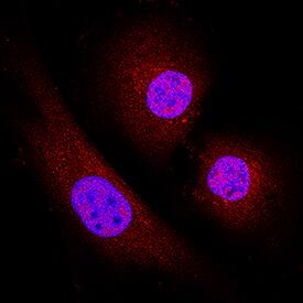 Immunocytochemistry Casein Kinase 1 delta Antibody [Unconjugated]