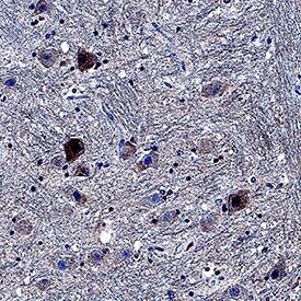 Casein Kinase 1 gamma  was detected in immersion fixed paraffin-embedded sections of human brain (substantia nigra) using Sheep Anti-Human/Mouse/Rat Casein Kinase 1 gamma  Antigen Affinity-purified Polyclonal Antibody (Catalog # AF3186) at 3 µg/mL overnight at 4 °C. Tissue was stained using the Anti-Goat HRP-DAB Cell & Tissue Staining Kit (brown; Catalog # CTS019) and counterstained with hematoxylin (blue). Specific staining was localized to neuronal cell bodies. View our protocol for Chromogenic IHC Staining of Paraffin-embedded Tissue Sections.