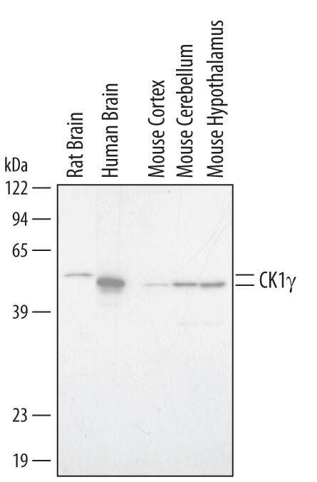 Western blot shows lysates of human, mouse and rat brain tissue. PVDF membrane was probed with 1 µg/mL of Sheep Anti-Human/Mouse/Rat Casein Kinase 1 gamma Antigen Affinity-purified Polyclonal Antibody (Catalog # AF3186) followed by HRP-conjugated Anti-Sheep IgG Secondary Antibody (Catalog # HAF016). Specific bands were detected for CK1 gamma isoforms at approximately 45 to 51 kDa (as indicated). This experiment was conducted using Immunoblot Buffer Group 1.