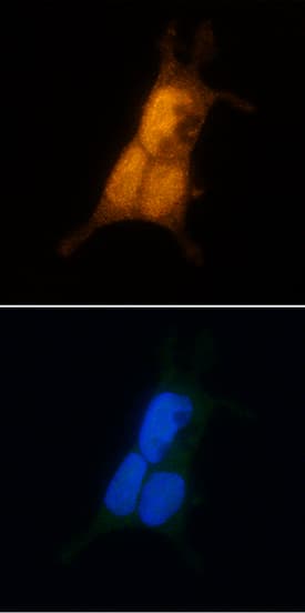 Immunocytochemistry Casein Kinase 2 alpha Antibody (844720) [Unconjugated]