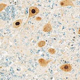 Immunohistochemistry Casein Kinase 2 alpha Antibody (844720) [Unconjugated]