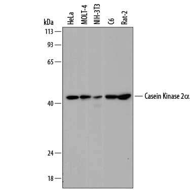 Western Blot Casein Kinase 2 alpha Antibody (844720) [Unconjugated]