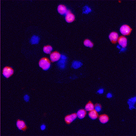 Pro Caspase-10 was detected in immersion fixed Jurkat human acute T cell leukemia cell line using Goat Anti-Human Pro Caspase-10 Antigen Affinity-purified Polyclonal Antibody (Catalog # AF6864) at 5 µg/mL for 3 hours at room temperature. Cells were stained using the NorthernLights™ 557-conjugated Anti-Goat IgG Secondary Antibody (red; Catalog # NL001) and counterstained with DAPI (blue). Specific staining was localized to cytoplasm. View our protocol for Fluorescent ICC Staining of Non-adherent Cells.