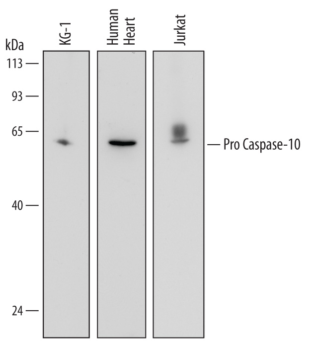 Western blot shows lysates of KG-1 human acute myelogenous leukemia cell line, human heart tissue, and Jurkat human acute T cell leukemia cell line. PVDF membrane was probed with 1 µg/mL of Goat Anti-Human Pro Caspase-10 Antigen Affinity-purified Polyclonal Antibody (Catalog # AF6864) followed by HRP-conjugated Anti-Goat IgG Secondary Antibody (Catalog # HAF017). A specific band was detected for Pro Caspase-10 at approximately 60 kDa (as indicated). This experiment was conducted under reducing conditions and using Immunoblot Buffer Group 2.