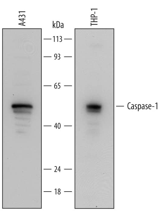Western blot shows lysates of A431 human epithelial carcinoma cell line and THP-1 human acute monocytic leukemia cell line. PVDF Membrane was probed with 0.25 µg/mL of Goat Anti-Human Caspase-1 Antigen Affinity-purified Polyclonal Antibody (Catalog # AF6215) followed by HRP-conjugated Anti-Goat IgG Secondary Antibody (Catalog # HAF109). A specific band was detected for Caspase-1 at approximately 50 kDa (as indicated). This experiment was conducted under reducing conditions and using Immunoblot Buffer Group 2.