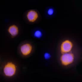 Caspase-1 was detected in immersion fixed THP-1 human acute monocytic leukemia cell line using Mouse Anti-Human Caspase-1 Monoclonal Antibody (Catalog # MAB6215) at 15 µg/mL for 3 hours at room temperature. Cells were stained using the Northern-Lights™ 557-conjugated Anti-Mouse IgG Secondary Antibody (yellow; Catalog # NL007) and counterstained with DAPI (blue). Specific staining was localized to cytoplasm. View our protocol for Fluorescent ICC Staining of Non-adherent Cells.
