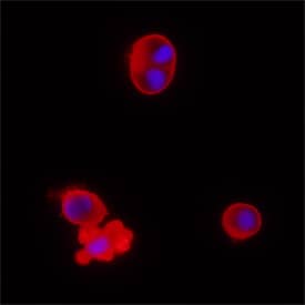 Caspase-2 was detected in immersion fixed Jurkat human acute T cell leukemia cell line treated with with staurosporin using Mouse Anti-Human Caspase-2 Monoclonal Antibody (Catalog # MAB7228) at 25 µg/mL for 3 hours at room temperature. Cells were stained using the NorthernLights™ 557-conjugated Anti-Mouse IgG Secondary Antibody (red; Catalog # NL007) and counterstained with DAPI (blue). Specific staining was localized to cytoplasm. View our protocol for Fluorescent ICC Staining of Non-adherent Cells.