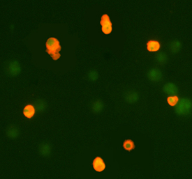 Caspase‑3 was detected in immersion fixed anti-FAS treated Jurkat human acute T cell leukemia cell line using 0.3 &micro;g/mL Human/Mouse Active Caspase‑3 Antigen Affinity-purified Polyclonal Antibody (Catalog # AF835) for 3 hours at room temperature. Cells were stained (red) and counterstained (green). View our protocol for Fluorescent ICC Staining of Cells on Coverslips.