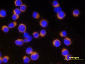 <b>Biological Strategies Validation. </b>Caspase-3 was detected in immersion fixed Jurkat human acute T cell leukemia cell line stimulated with staurosporin using Human/Mouse Active Caspase-3 Antigen Affinity-purified Polyclonal Antibody (Catalog # AF835) at 10 µg/mL for 3 hours at room temperature. Cells were stained using the NorthernLights™ 557-conjugated Anti-Rabbit IgG Secondary Antibody (yellow; Catalog # NL004) and counterstained with DAPI (blue). View our protocol for Fluorescent ICC Staining of Cells on Coverslips.