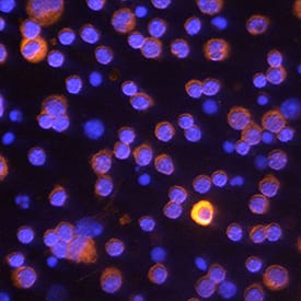 Caspase-11/Caspase-4 was detected in immersion fixed mouse splenocytes treated with LPS using Rat Anti-Mouse Caspase-11/Caspase-4 Monoclonal Antibody (Catalog # MAB86481) at 25 µg/mL for 3 hours at room temperature. Cells were stained using the NorthernLights™ 557-conjugated Anti-Rat IgG Secondary Antibody (red; Catalog # NL013) and counterstained with DAPI (blue). Specific staining was localized to cytoplasm. View our protocol for Fluorescent ICC Staining of Non-adherent Cells.