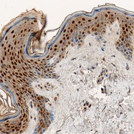 Caspase-14 was detected in immersion fixed paraffin-embedded sections of human epidermis using Mouse Anti-Human Caspase-14 Monoclonal Antibody (Catalog # MAB8215) at 15 µg/mL overnight at 4 °C. Tissue was stained using the Anti-Mouse HRP-DAB Cell & Tissue Staining Kit (brown; Catalog # CTS002) and counterstained with hematoxylin (blue). Specific staining was localized to the nuclei of suprabasal keratinocytes. View our protocol for Chromogenic IHC Staining of Paraffin-embedded Tissue Sections.